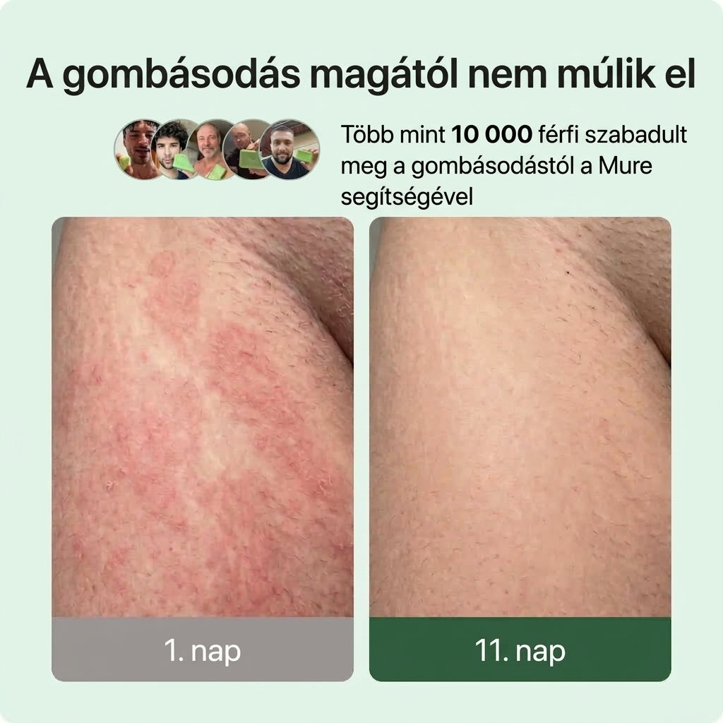 Mure Gombaellenes Szappan