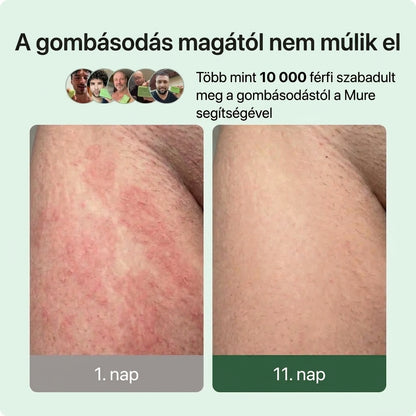 Mure Gombaellenes Szappan