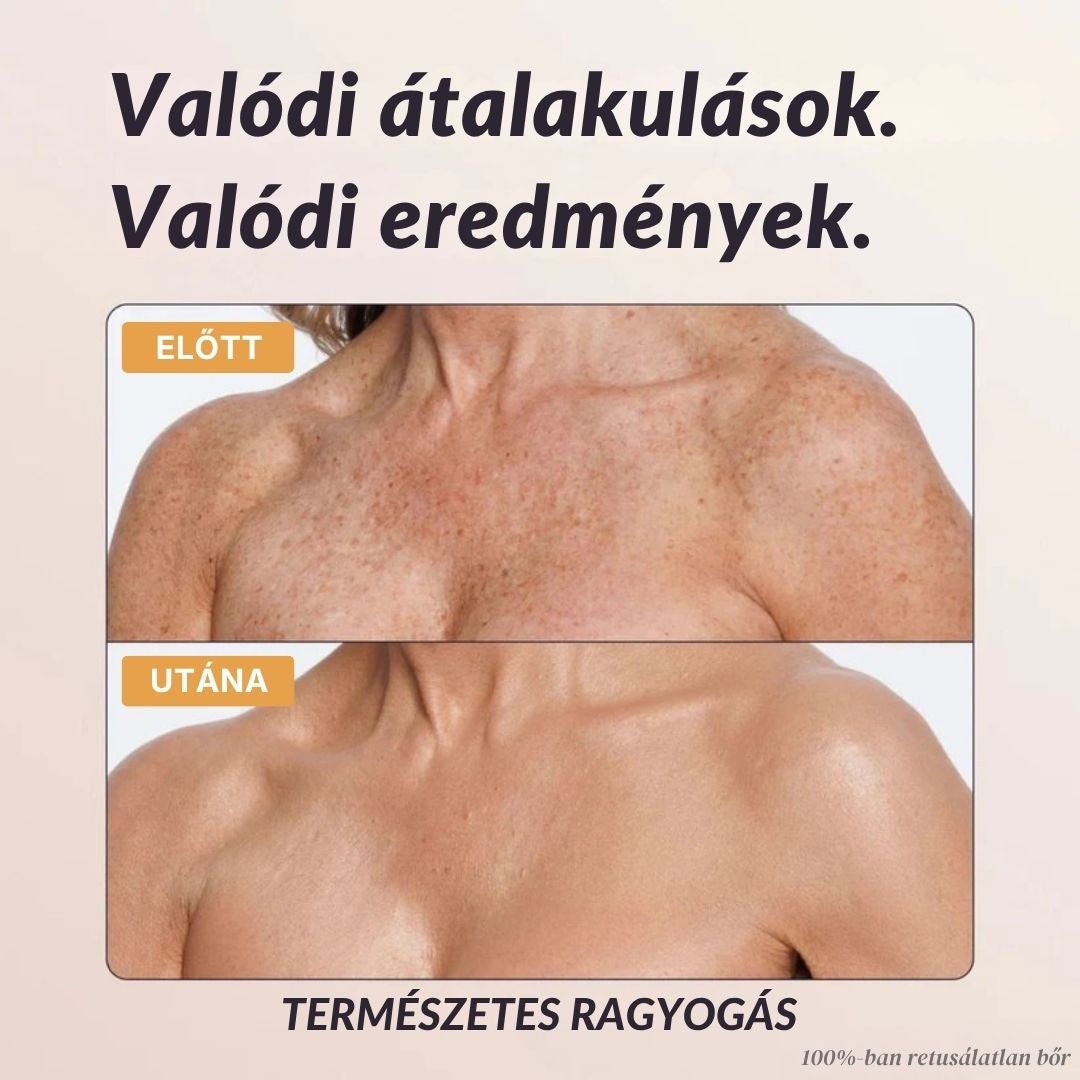 Mure Azonnali Testtökéletesítő