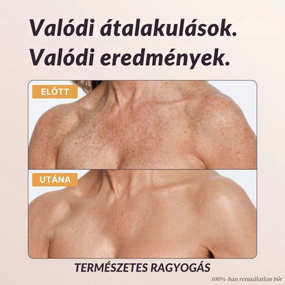 Mure Azonnali Testtökéletesítő