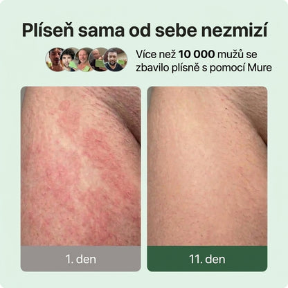 Mure Antimykotické mýdlo